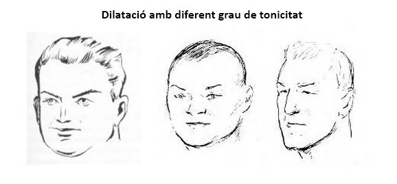 dilatado_tonic