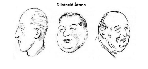 dilatat_aton